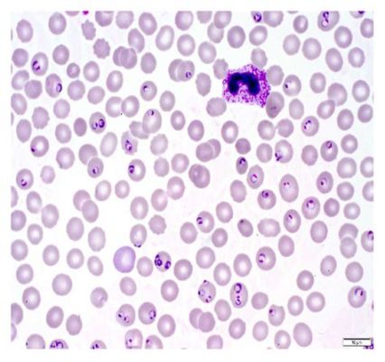  Plasmodium - Mikroskopijne stworzenie o wielkim wpływie na ludzkie zdrowie!