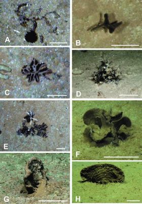  Xenophyophore! A Microscopic Masterpiece of Nature’s Complexity